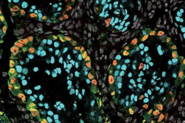 Microscopic Spermatogonia.