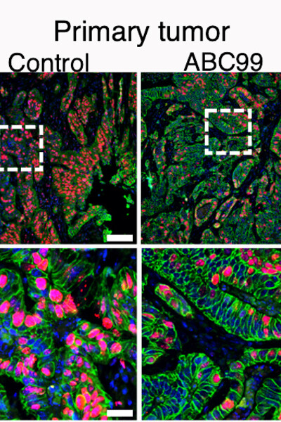 Fluorescent microscopy of colon cancer with and without NOTUM inhibition.